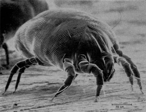 A magnified photo of a house dust mite